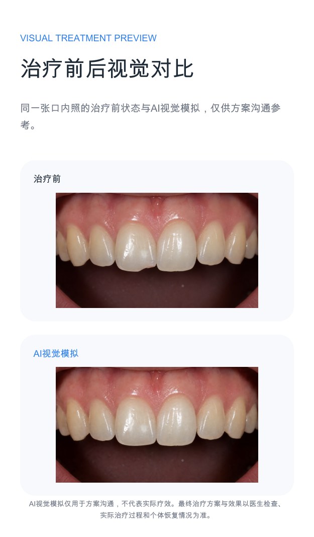 效果模拟示例第2页：治疗前与视觉预览